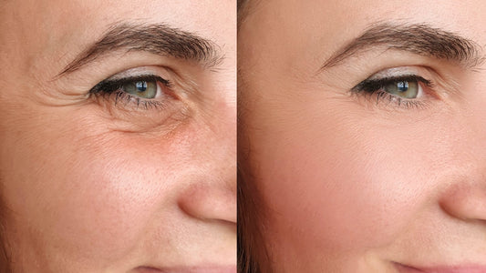 Before and after comparison showing youthful radiant skin results from using top anti-aging serums
